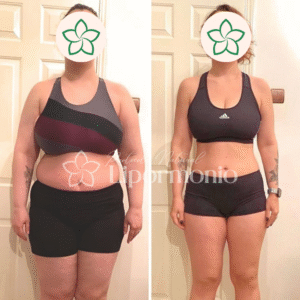 Antes&Depois_LipormonioNew (2)