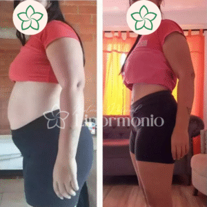 Antes&Depois_LipormonioNew (7)